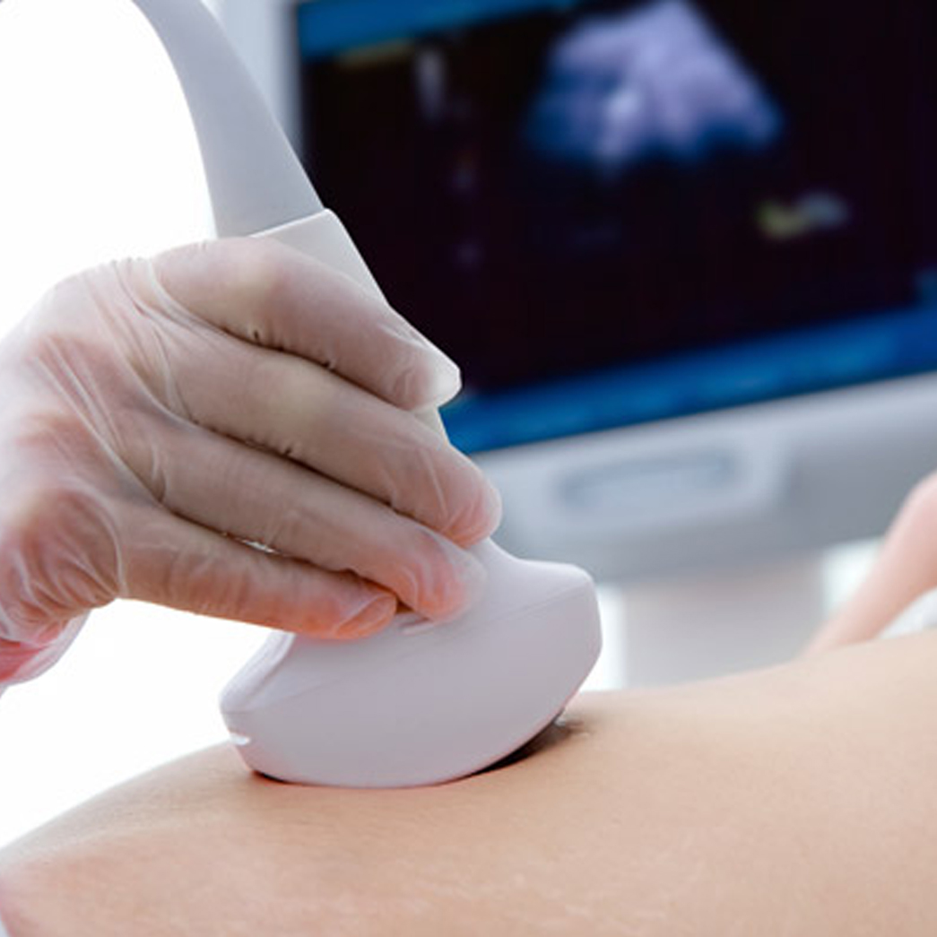 Prenatal Genetic Screening